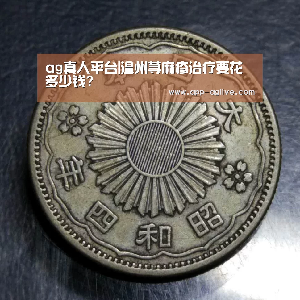 ag真人平台|温州荨麻疹治疗要花多少钱?