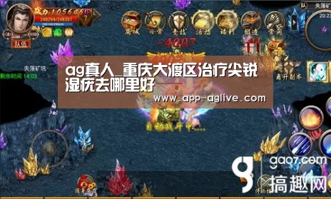 ag真人_重庆大渡区治疗尖锐湿疣去哪里好